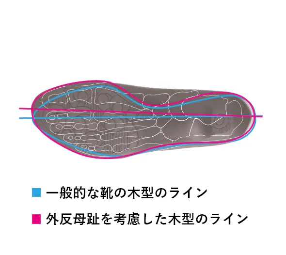 親指を圧迫しない外反母趾にもやさしい靴